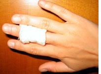 Blistered and bandaged finger