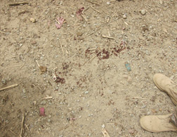 Blood from an IED explosion. Click image to expand.