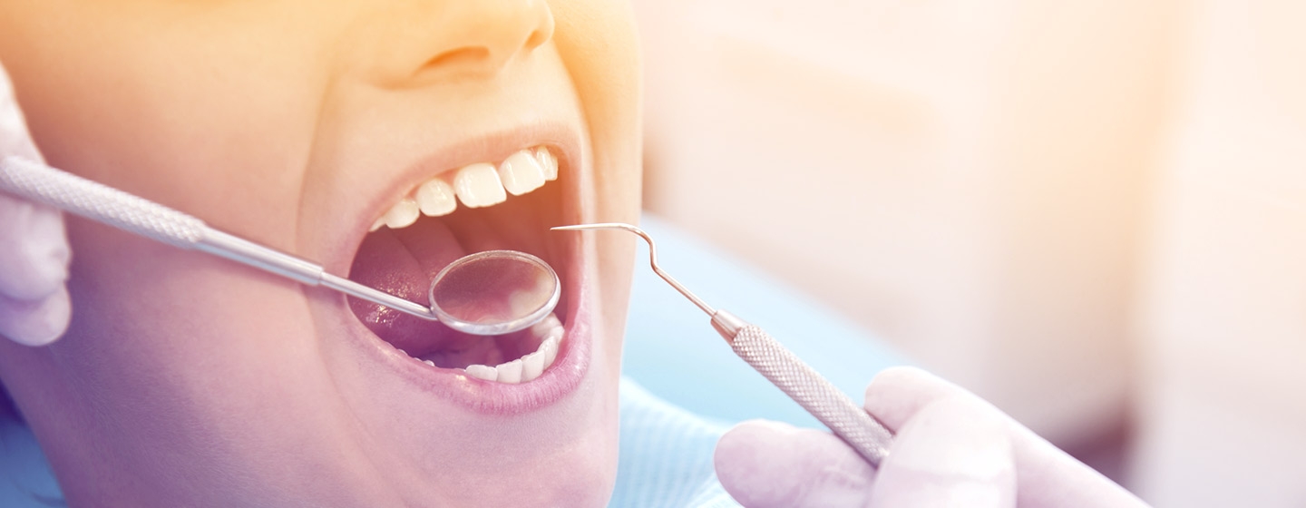 What does Medicaid for dental cover?