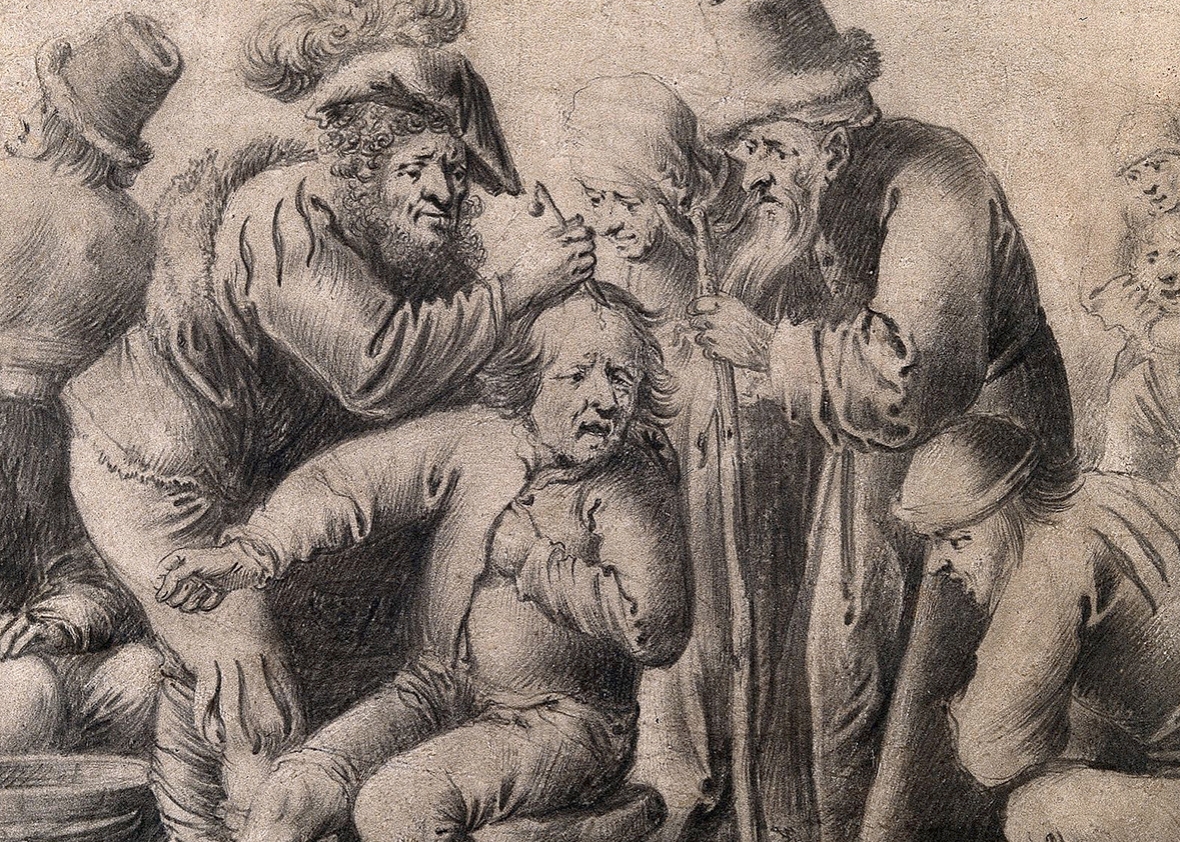 An itinerant surgeon extracting stones from a man's head.
