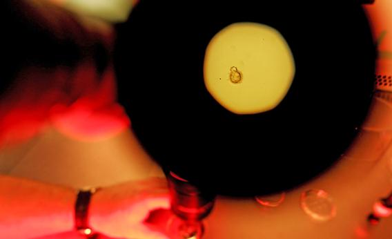 A donated human embryo is seen through a microscope at the La Jolla IVF Clinic Feb. 28, 2007, in La Jolla, Calif.