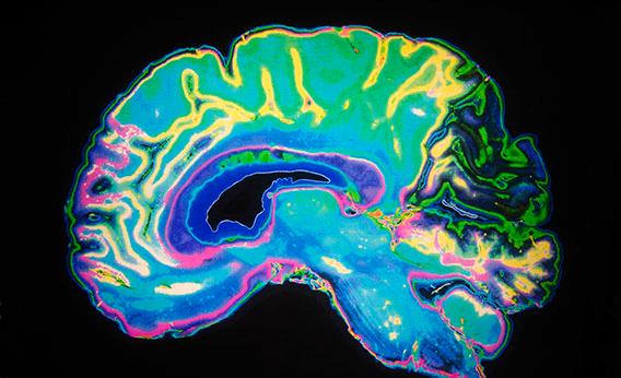Colored MRI Scan Of Human Brain.
