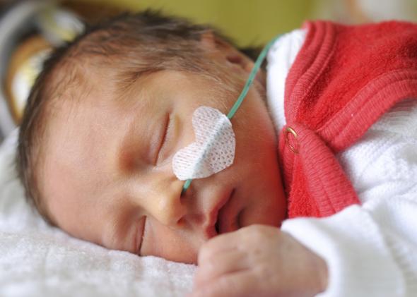 premature baby feeding