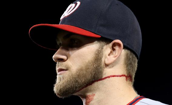 Right fielder Bryce Harper #34 of the Washington Nationals walks off the field as he bleeds from the neck after running into the wall chasiing a triple hit by A.J. Ellis of the Los Angeles Dodgers in the fifth inning at Dodger Stadium on May 13, 2013 in Los Angeles, California.