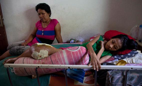 Cancer patient in East Timor.