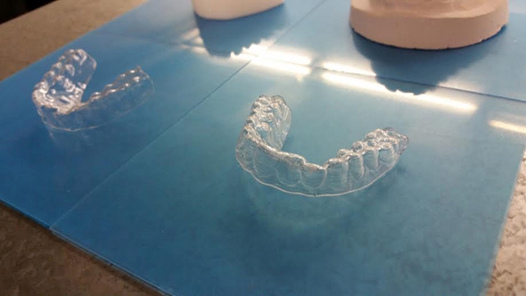 retainer1 retainer1