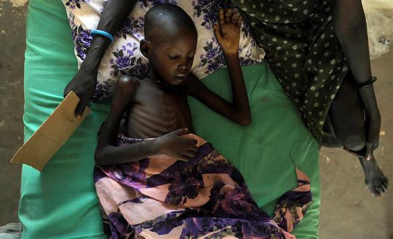 Girl ailing from malaria and anaemia.