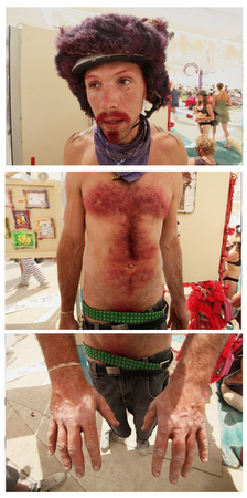 images%2Fslides%2Fburnerpotraits_06